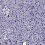 ARMC2 Antibody in Immunohistochemistry (IHC)