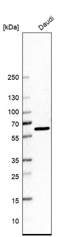 ELP3 Antibody in Western Blot (WB)