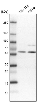 ELP3 Antibody in Western Blot (WB)