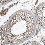 ZNF345 Antibody in Immunohistochemistry (Paraffin) (IHC (P))