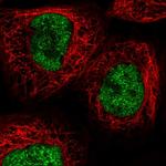 RECQ4 Polyclonal Antibody