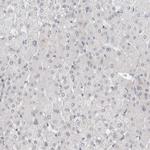 RECQ4 Antibody in Immunohistochemistry (Paraffin) (IHC (P))
