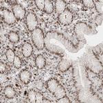 RECQ4 Antibody in Immunohistochemistry (Paraffin) (IHC (P))