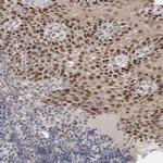 RECQ4 Antibody in Immunohistochemistry (Paraffin) (IHC (P))