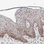 MRPL37 Polyclonal Antibody