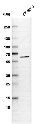 Ribophorin II Antibody in Western Blot (WB)