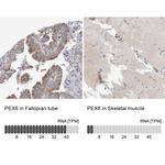 PEX6 Polyclonal Antibody