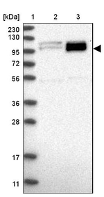 PEX6 Antibody in Western Blot (WB)