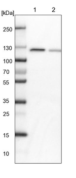 PEX6 Antibody in Western Blot (WB)