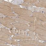 Phafin 1 Antibody in Immunohistochemistry (IHC)