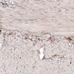 NMU Polyclonal Antibody