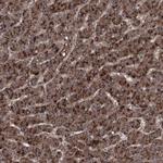RSU1 Antibody in Immunohistochemistry (Paraffin) (IHC (P))