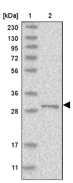RSU1 Antibody in Western Blot (WB)