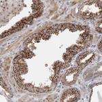 RAB18 Antibody in Immunohistochemistry (Paraffin) (IHC (P))