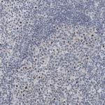 UTP6 Antibody in Immunohistochemistry (IHC)