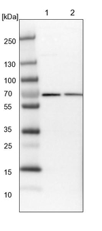 UTP6 Antibody in Western Blot (WB)