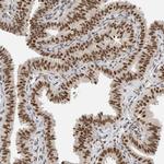 DDX42 Antibody in Immunohistochemistry (IHC)
