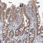 MRPL37 Antibody in Immunohistochemistry (Paraffin) (IHC (P))
