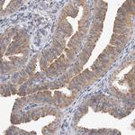 MRPL37 Antibody in Immunohistochemistry (Paraffin) (IHC (P))