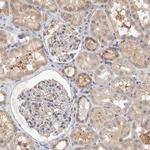 MRPL37 Antibody in Immunohistochemistry (Paraffin) (IHC (P))
