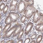 MRPL37 Antibody in Immunohistochemistry (Paraffin) (IHC (P))