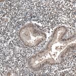 PHF15 Antibody in Immunohistochemistry (Paraffin) (IHC (P))