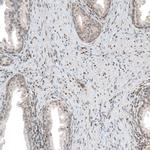 PHF15 Antibody in Immunohistochemistry (Paraffin) (IHC (P))