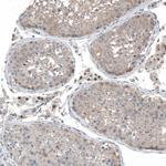 PHF15 Antibody in Immunohistochemistry (Paraffin) (IHC (P))