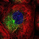 RAB11FIP1 Polyclonal Antibody