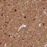 NECAB1 Antibody in Immunohistochemistry (IHC)