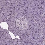 NECAB1 Antibody in Immunohistochemistry (IHC)