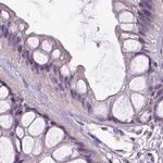 NECAB1 Antibody in Immunohistochemistry (IHC)