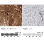Plectin Antibody