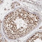 ZNF83 Antibody in Immunohistochemistry (Paraffin) (IHC (P))