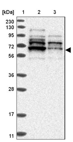 ZNF83 Antibody in Western Blot (WB)