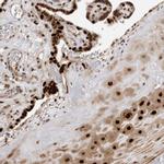 PEG3 Antibody in Immunohistochemistry (Paraffin) (IHC (P))