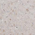 REPS2 Polyclonal Antibody