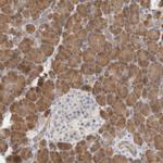 SYTL5 Antibody in Immunohistochemistry (Paraffin) (IHC (P))