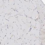 SYTL5 Antibody in Immunohistochemistry (Paraffin) (IHC (P))