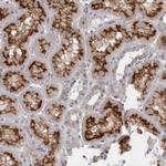 SLC22A11 Polyclonal Antibody