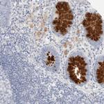 ADAM30 Polyclonal Antibody