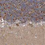 ARMC1 Antibody in Immunohistochemistry (Paraffin) (IHC (P))