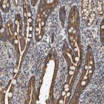 ARMC1 Antibody in Immunohistochemistry (Paraffin) (IHC (P))
