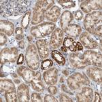 ARMC1 Antibody in Immunohistochemistry (Paraffin) (IHC (P))