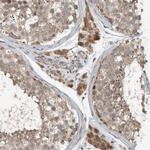 ARMC1 Antibody in Immunohistochemistry (Paraffin) (IHC (P))