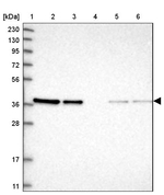 ARMC1 Antibody in Western Blot (WB)