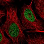 hnRNP R Polyclonal Antibody