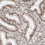 hnRNP R Antibody in Immunohistochemistry (IHC)