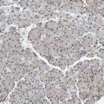 hnRNP R Antibody in Immunohistochemistry (IHC)