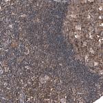 C7orf72 Antibody in Immunohistochemistry (Paraffin) (IHC (P))